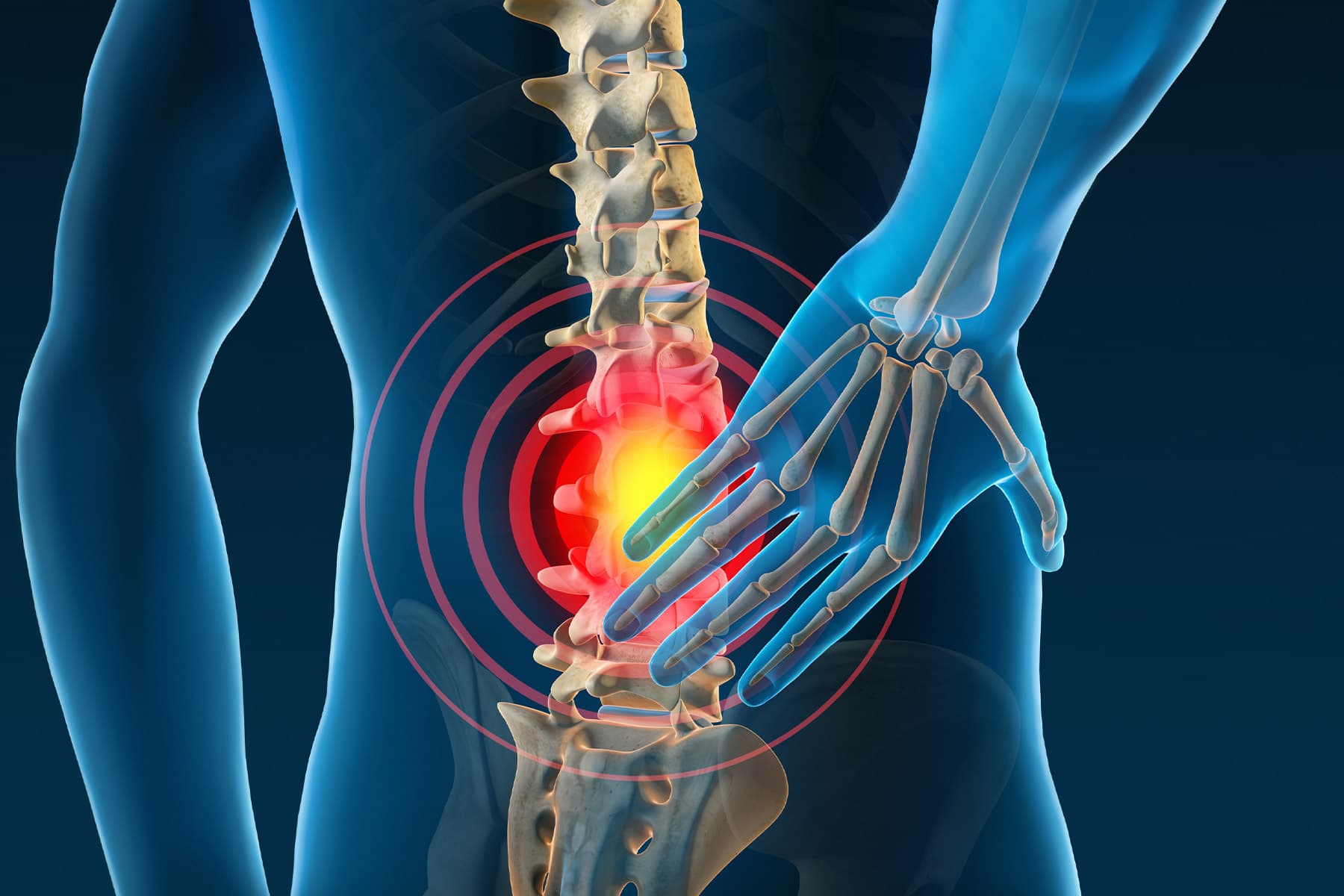 Back Pain: Causes, Symptoms, and Effective Home Remedies
