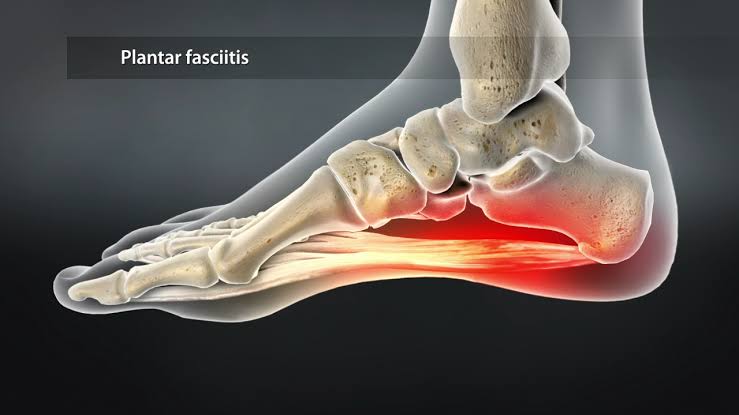 Physiotherapy for Musculoskeletal, Orthopedic & Sports Conditions – KRP Health Care